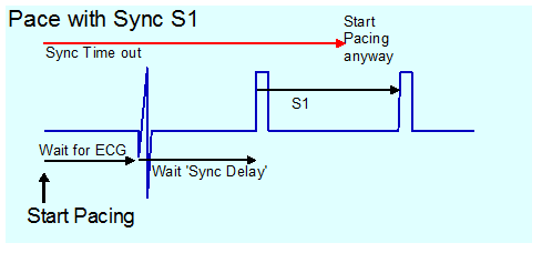 Pacing - Delay first S1